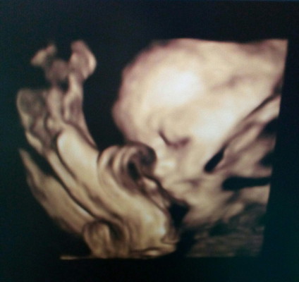 นู๋27w6dแล้วค่ะ