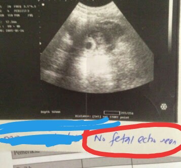 9 week