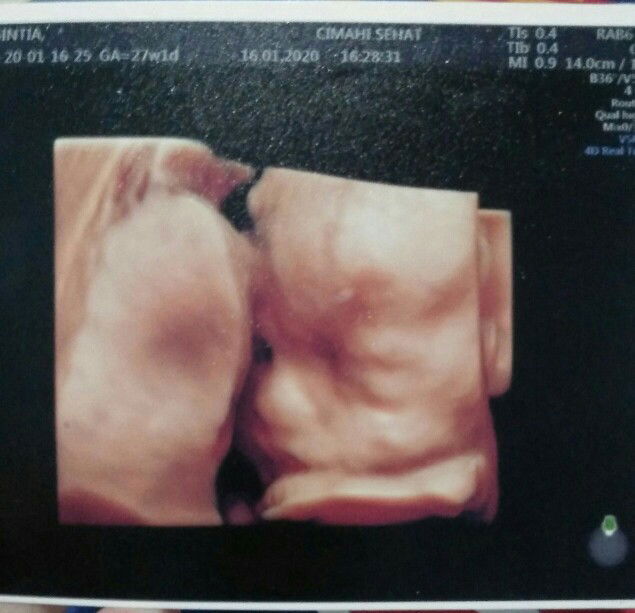 RISKA SINTIA FEBRIANTI profile icon