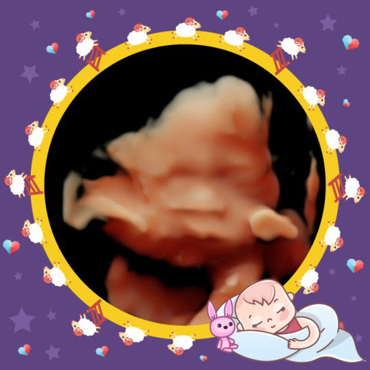 afri yantikyu profile icon