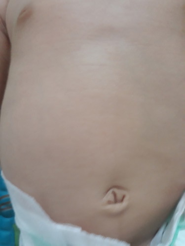 puser bodong atau tidak