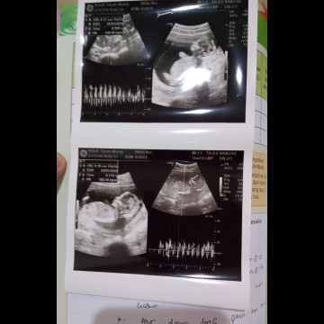 baby twins