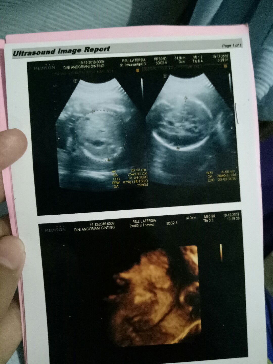 kecewaaaaa sama usg terakhir ?