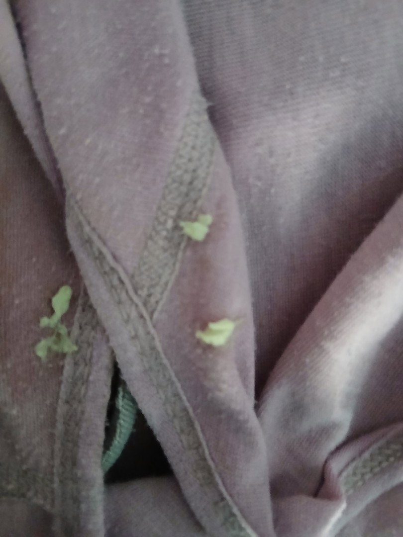 Keputihan hormon karna hamil / tdk wajar?