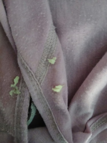 Keputihan hormon karna hamil / tdk wajar?