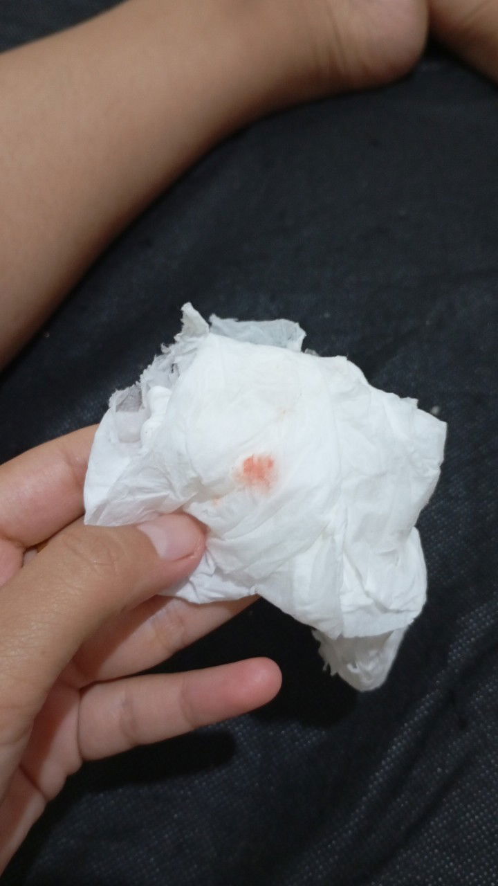 Flek di usia 14 minggu