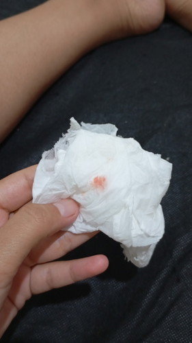 Flek di usia 14 minggu