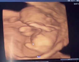 แม่Pat profile icon