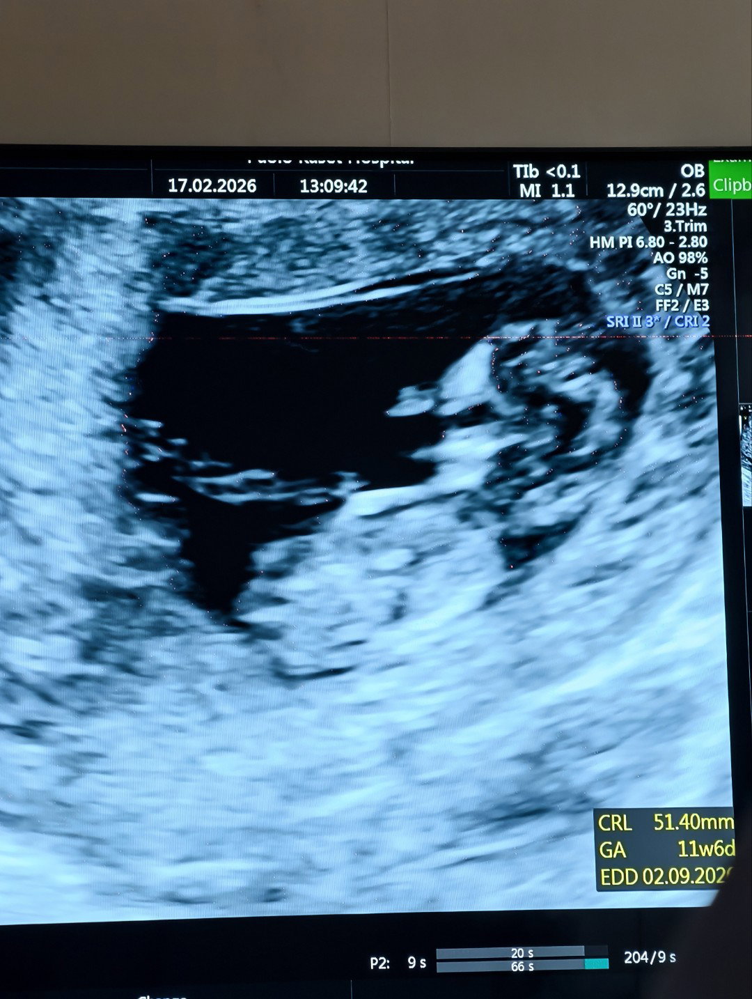 Noey Monthira profile icon