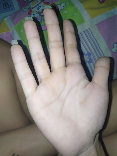มือเหลือง
