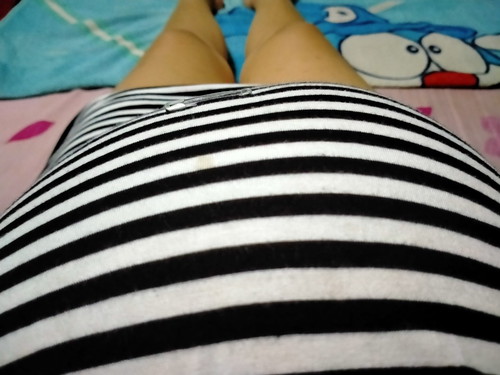 ท้องเอียง