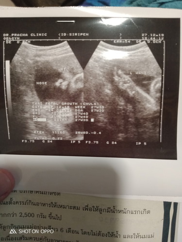 กำหนด23มีนาค่ะ