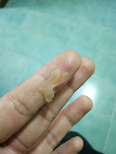 มันคืออะไรคะ