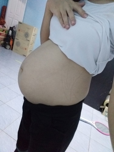 แม่ๆช่วยดูหน่อยค่ะ ท้องต่ำรึยัง มีแต่คนทักแล้วว่าท้องต่ำลงแล้ว 29 week ท้อง2จ้า