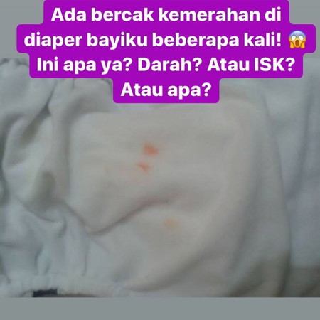 SHARE Penjelasan dokterapin Bercak orange pada popok :)