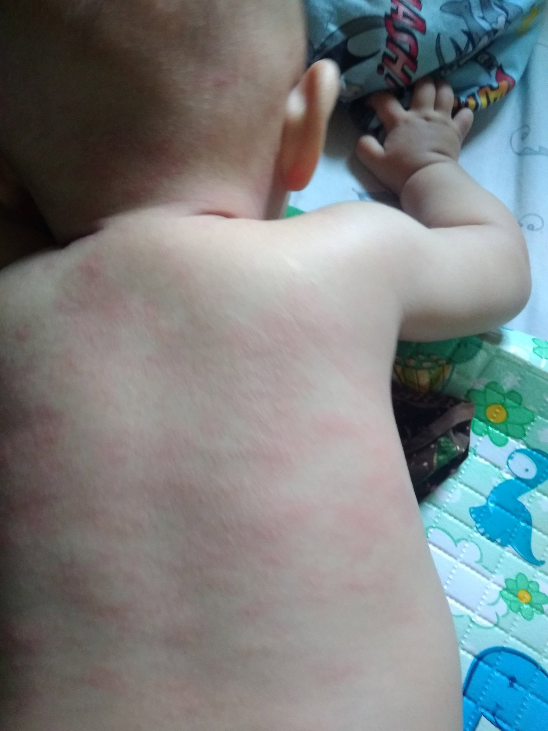 merah merah bintik kasar