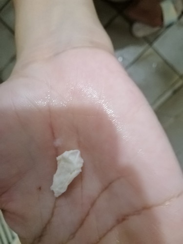 Pls Help Me About My Discharge