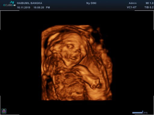 Sharing USG di haibumil.id Bangka