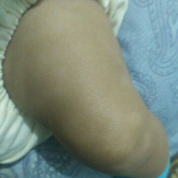 Belang Putih Di Badan