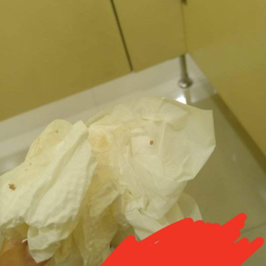 มีก้อนเล็กๆคล้ายหมูสับหล่นในชักโครกอยากทราบว่าอันตรายไหมคะ