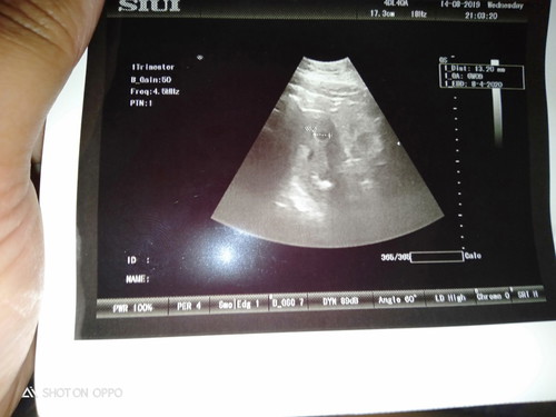 minta pendapat yaa bun ??