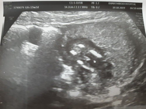 13 w 2 d ...เพศไรกันน้าาาา