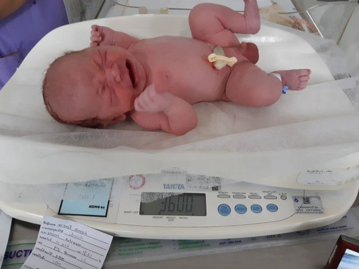 คลอดแล้วจ้า