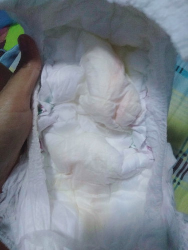 น้องฉี่สีส้ม