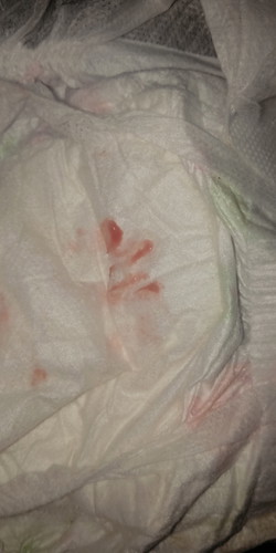 keluar tanda tpi tak de sakit