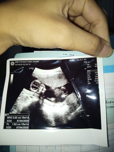 วิธีดูใบอัลตราซาวนด์