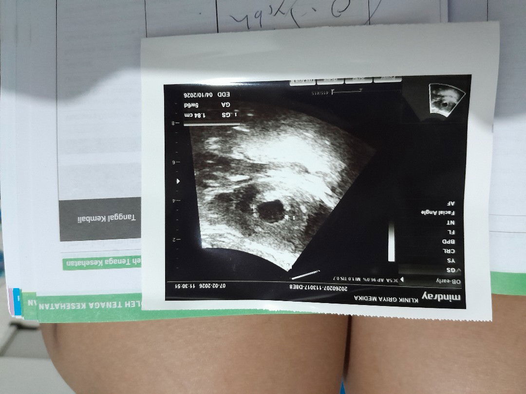 Usia kehamilan 5 minggu 6 hari