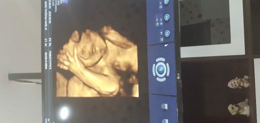 agar melahirkan secara normal