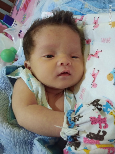 ลูกแหวะนม