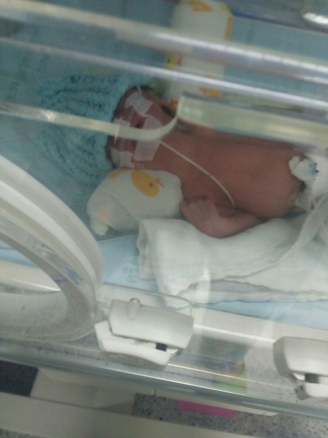 คลอดก่อนกำหนด