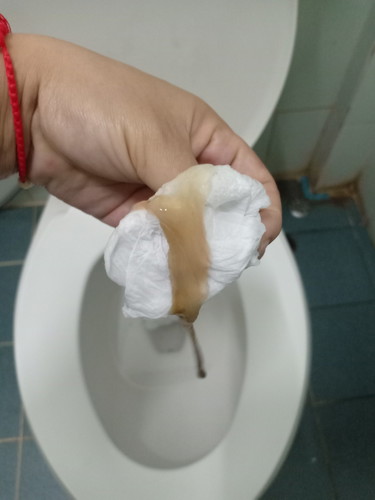 แบบนี้ใช่มูกไหมคะ ท้องแรกไม่ทราบจริงๆ 39+4