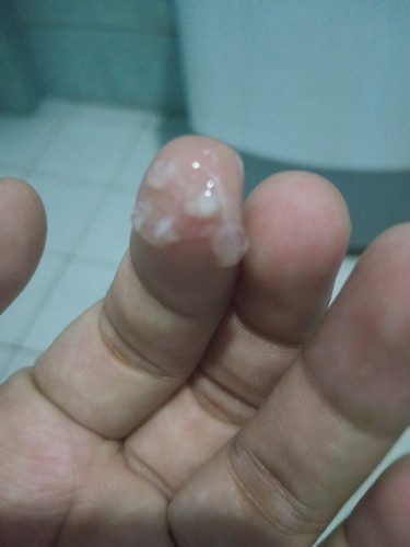 mucus plug