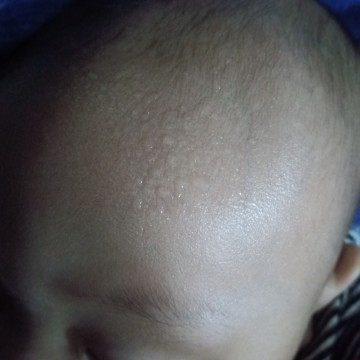 sobrang pawisin ni baby