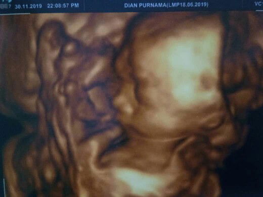 Dian Purnama profile icon