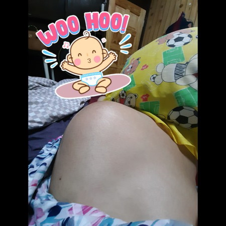 สะดือไม่มีความรู้สึก