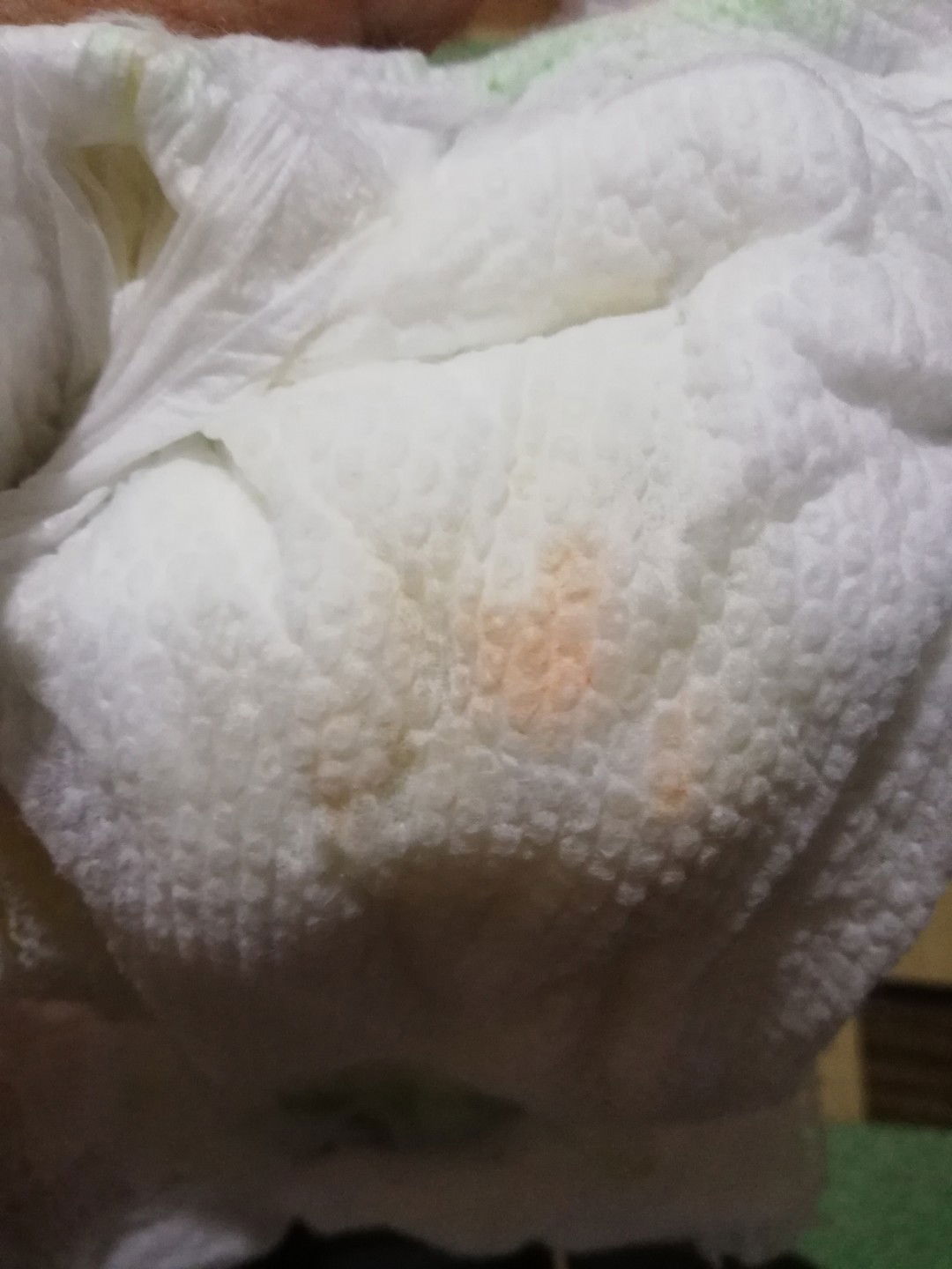 Pangangati ni pitoy ni baby..