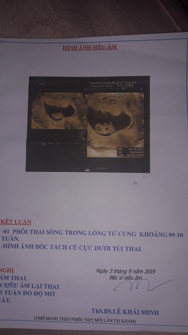 Hôm bữa e đi siêu âm