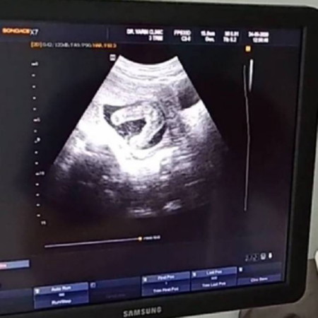 ญ/ช น๊าา ??