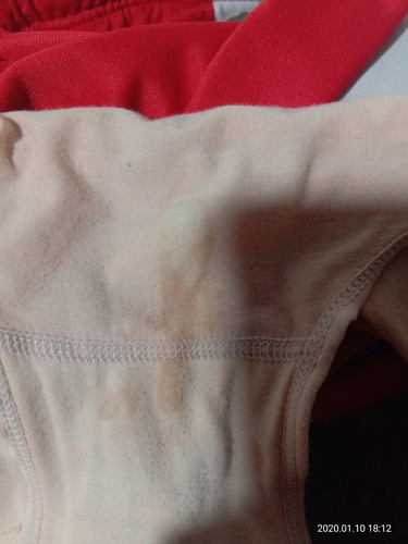 vaginal discharge part 2