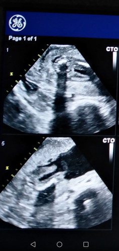 ชาย หรือ หญิงค่ะ