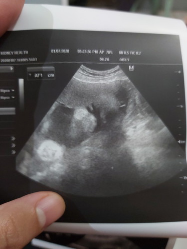 31 weeks ultrasound