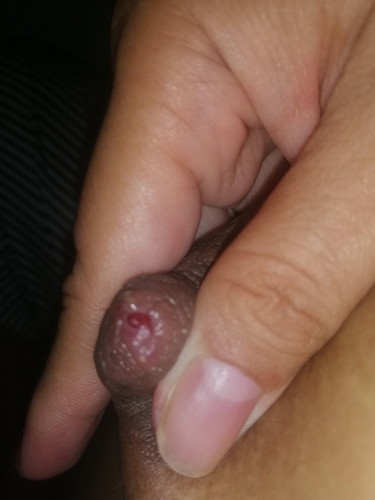 Trying To Breastfed