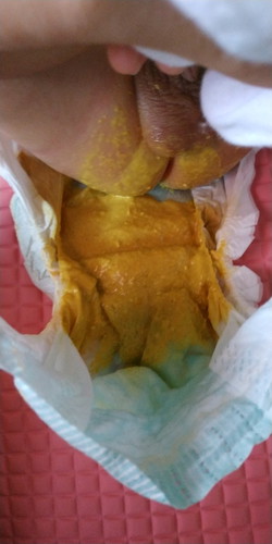 Poopoo ni baby going 2 months