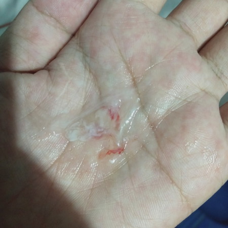 แบบนี้ไหลออกมา