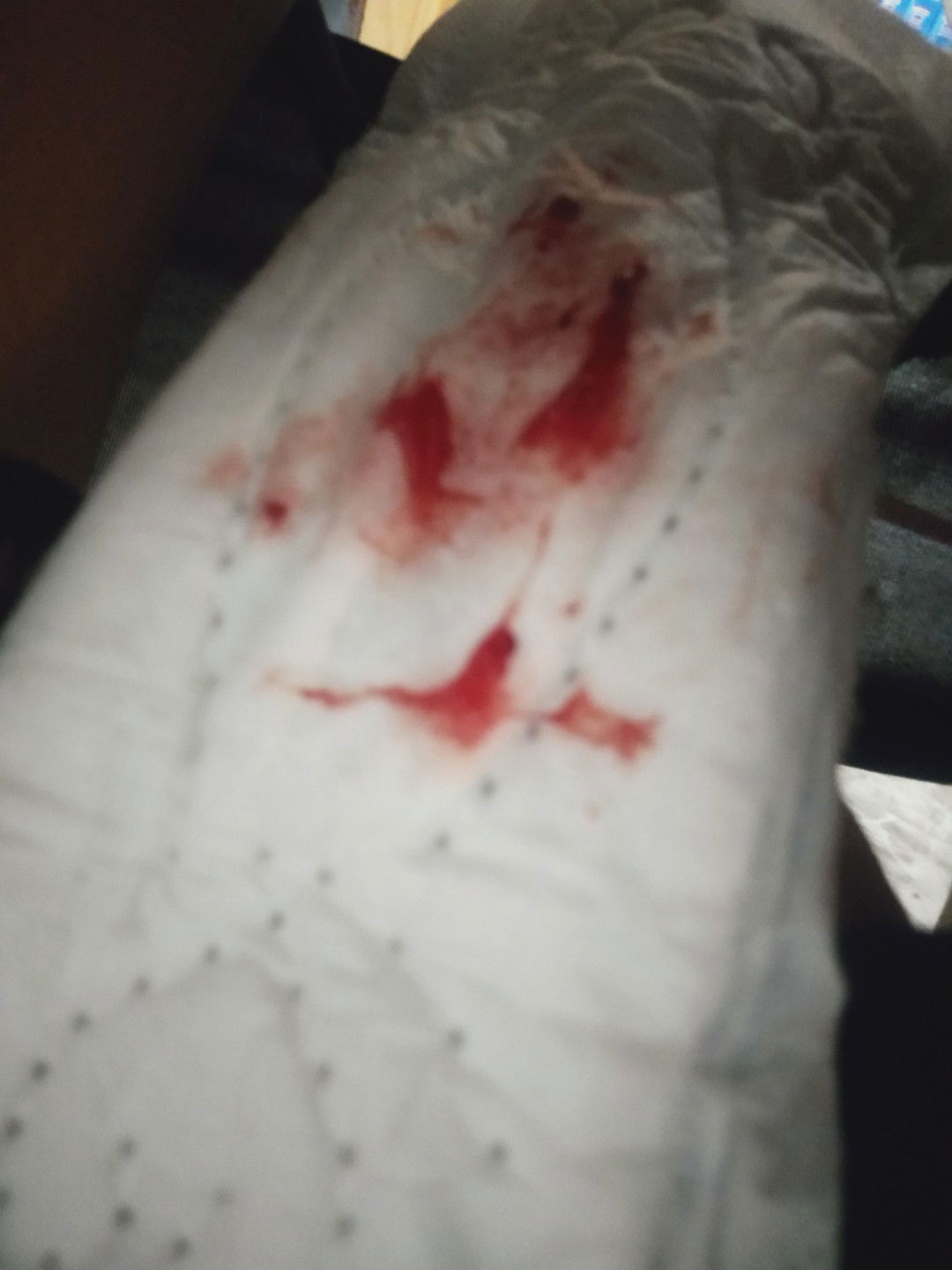 แบบนี้คะ แต่หมอไม่ทำไรให้