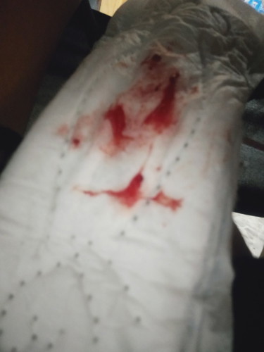 แบบนี้คะ แต่หมอไม่ทำไรให้